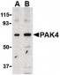 PAK4 Antibody (Internal)